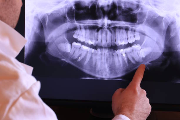 Best After-Hours Emergency Dentist in New Bremen, OH