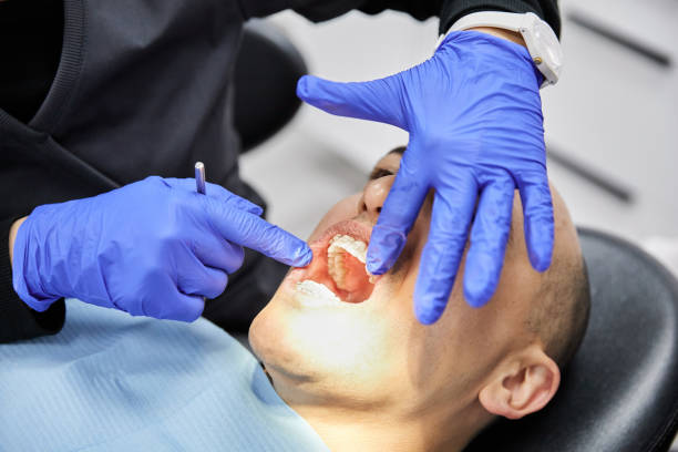 Emergency Dental Fillings